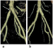 Abb. 2a-b: Becken-Arterien