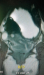 Aktuelles Bild - Abb. 1: Vaginalstenose