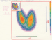 Aktuelles Bild - Abb. 1: Hyperthyreose