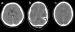 Abb. 1a-c: CCT