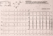 Abb. 2: EKG