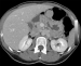 Aktuelles Bild - Abb. 3: MDCT