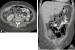 Abb. 1a-b: CT