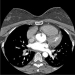 Abb. 2: CT-Angiographie