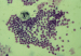 Aktuelles Bild - Abb. 4: Zytologie - Schilddrüse