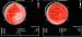 Abb. 6: Longitudinale Strains