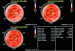 Aktuelles Bild - Abb. 8: Speckletracking