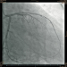 Aktuelles Bild - Abb. 2: Angiographie