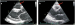 Abb. 1: Echokardiographie