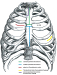 Abb. 1: Aortenklappenchirurgie - OP-Techniken