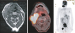 Aktuelles Bild - Abb. 2: MRI - PET-CT