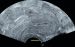 Abb. 1: Ultraschall-Serometra