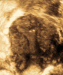 Aktuelles Bild - Abb. 2: Subendometriale Fibrose