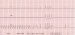 Aktuelles Bild - Abb. 2: EKG - Monitoring