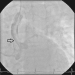 Abb. 5: Angiographie