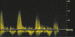 Abb. 7: CW-Doppler-Signal