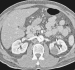 Abb. 8: CT-Angiographie