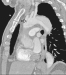 Aktuelles Bild - Abb. 9: CT-Angiographie