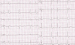 Aktuelles Bild - Abb. 1: EKG