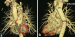 Aktuelles Bild - Abb. 1a-b: CT-Angiographie