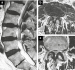 Abb. 1a-c: Vertebrostenose