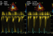 Aktuelles Bild - Abb. 2: Aortenstenose