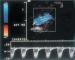Aktuelles Bild - Abb. 18: Duplexsonographie - Fluß retrograd