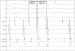 Aktuelles Bild - Abb. 5: EKG 