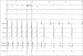 Abb. 6: EKG