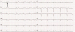 Aktuelles Bild - Abb. 10: EKG