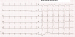 Abb. 2: EKG