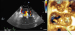Abb. 5a-b: MitraClip®-Implantation
