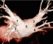 Abb. 1: Multispiral CT