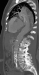 Abb. 1: Produkt: Stentgraft<br>
Vertrieb: Jotec GmbH