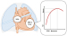 Abb. 2: COPD