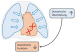 Abb. 4: COPD