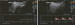 Aktuelles Bild - Abb. 2: Ilio-femoraler Bypass