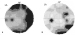 Abb. 6A-B: Perimetrie