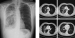 Abb. 2: Radiologie
