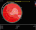 Abb. 3: Bull's Eye-View 