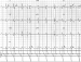 Abb. 3: Ruhe-EKG