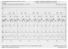 Abb. 2: EKG