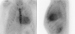 Aktuelles Bild - Abb. 3: Szintigraphie