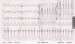 Aktuelles Bild - Abb. 2: EKG