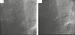 Abb. 3: Ablation
