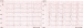 Aktuelles Bild - Abb. 1: EKG