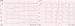 Abb. 3: EKG