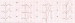 Abb. 4: EKG