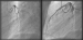 Abb. 6: Thrombose