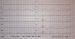 Aktuelles Bild - Abb. 1: EKG